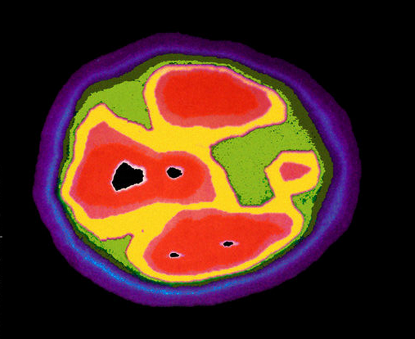 m1080664-autism_pet_scan-spl.png