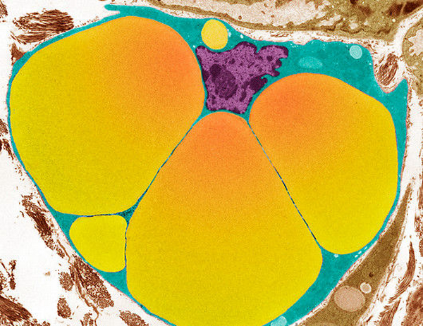 p7600048-fat_cell_tem-spl.png