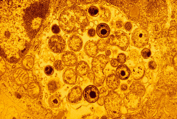 b2200332-chlamydia_psittaci_bacteria_in_lung_cell-spl.png