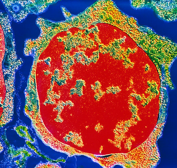 p2340032-colour_tem_of_an_erythroblast_cell_in_bone_marrow-spl.png