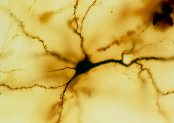 p3600070-light_micrograph_of_a_pyramidal_neuron-spl.png