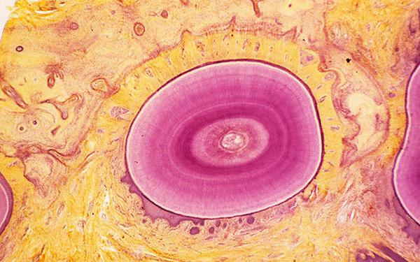 p4860099-tooth_light_micrograph-spl.png