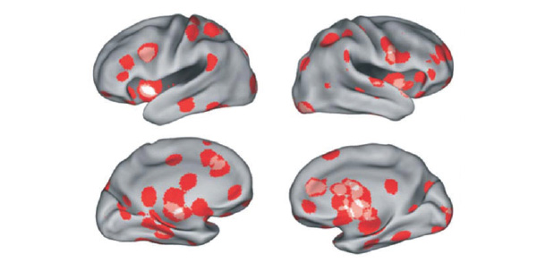 fmri_of_love_600.jpg