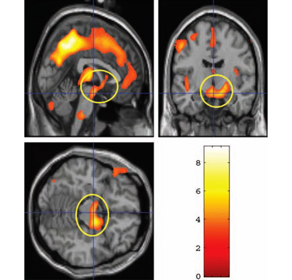 maternal_brain_fig2_600.jpg