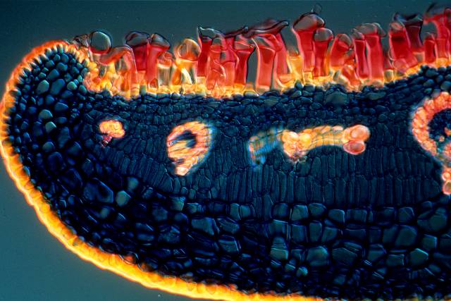 lenta-microscop-2.jpg