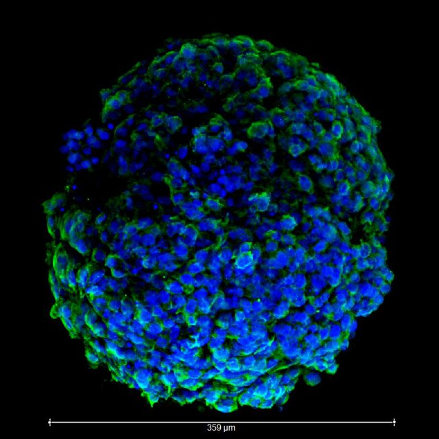 geektimes-heart-organoid-2.jpg