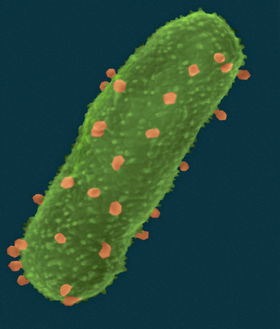 nkj-bacterium-1.jpg