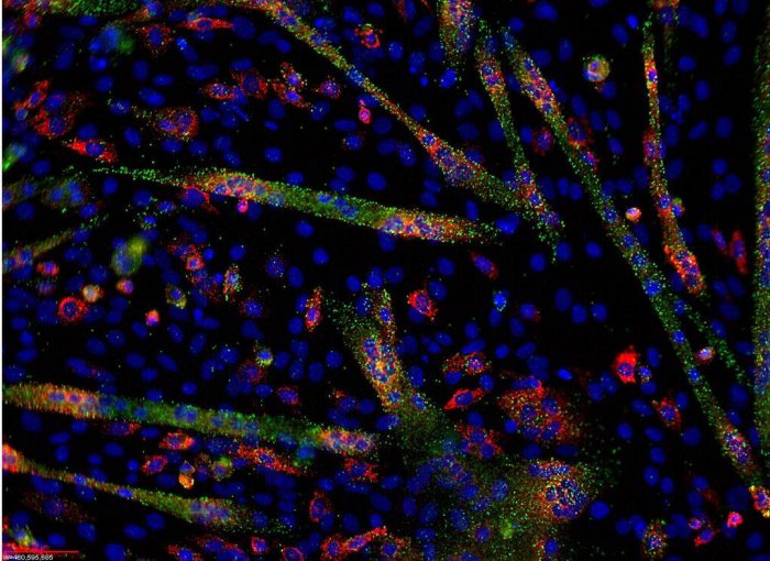 1024px-microrna_and_mrna_visualization_in_differentiating_c1c12_cells.jpg